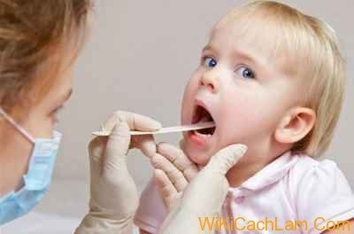 Cách phòng ngừa và điều trị viêm amidan ở trẻ em