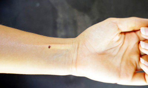 Xem bói nốt ruồi trong lòng bàn tay trái phải của nam nữ đoán vận mệnh-9